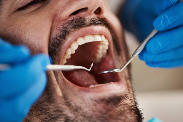 Best Emergency Dentist for Knocked-Out Tooth in Sparta, NC